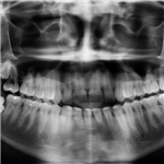 Radiologia odontoiatrica sempre più vicina